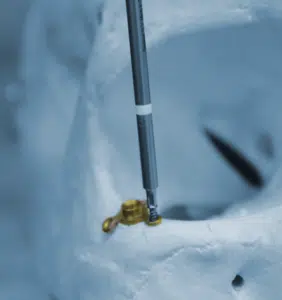 Fixierung der Epiplating Platte. ChatGPT: Das Bild zeigt eine medizinische Operation an einem Schädelmodell. Ein medizinisches Implantat, ähnlich dem in den vorherigen Bildern (das goldfarbene, schraubbare Implantat), wird gerade mit einem chirurgischen Instrument an einem Knochen befestigt.