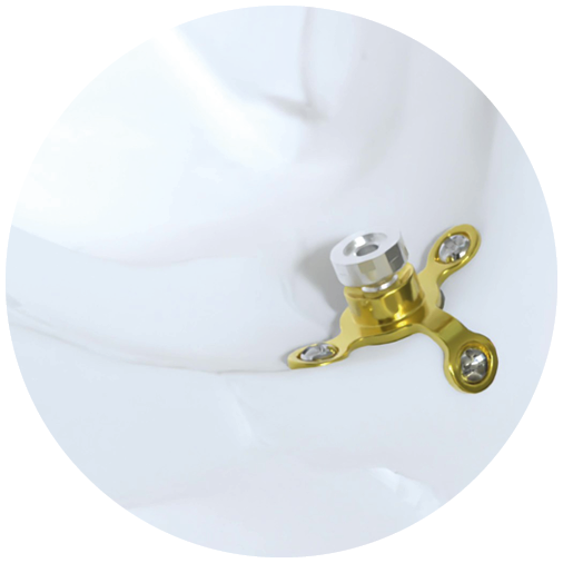 Epiplating MONO Implant