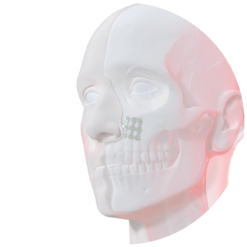 Epiplating MINI Facial Skull