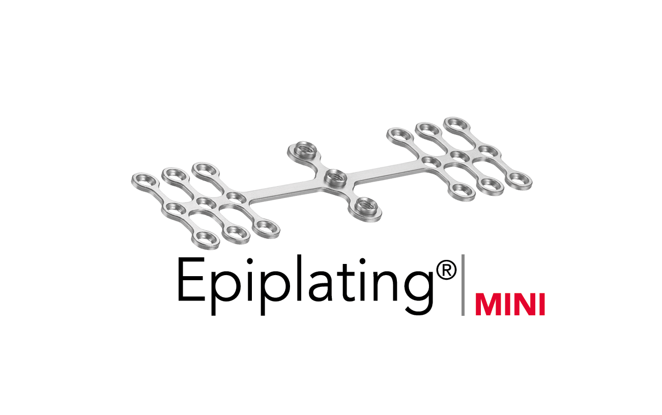 Epiplating MINI