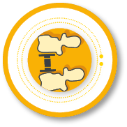MediExpand-TL_Icon_Distrahierbarer Wirbelkörperersatz