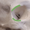 Knochenschädel_Position der Augenplatte. Auf dem Bild ist der obere und untere Rand der Augenhöhle (Orbita) grün markiert. Der obere grüne Bereich entspricht dem Orbitalrand (Rand der Augenhöhle), der hauptsächlich vom Stirnbein (Os frontale) gebildet wird. Der untere grüne Bereich ist der untere Orbitalrand, der vor allem vom Jochbein (Os zygomaticum) gebildet wird.