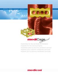 ChatGPT: Diese Titelseite zeigt das Thema mediCage Cervical und bezieht sich auf Implantate für die zervikale Wirbelsäule (Halswirbelsäule). Das Bild stellt eine stilisierte Darstellung der Halswirbelsäule mit einem implantierten Cage (Implantat) dar, dargestellt in einem leuchtenden Gelbton, während die Wirbelsäule im Hintergrund rot dargestellt ist. Dieses Implantat wird verwendet, um die Stabilität und Unterstützung der Halswirbelsäule nach Verletzungen oder Operationen zu gewährleisten. Darunter steht in mehreren Sprachen der Hinweis auf Implantate für die zervikale Wirbelsäule, sowie das Medicon-Logo.