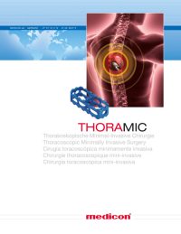 Titelblatt einer Medicon-Broschüre mit einer medizinischen Darstellung der Wirbelsäule und eines Implantats, Fokus auf thorakoskopische minimal-invasive Chirurgie.